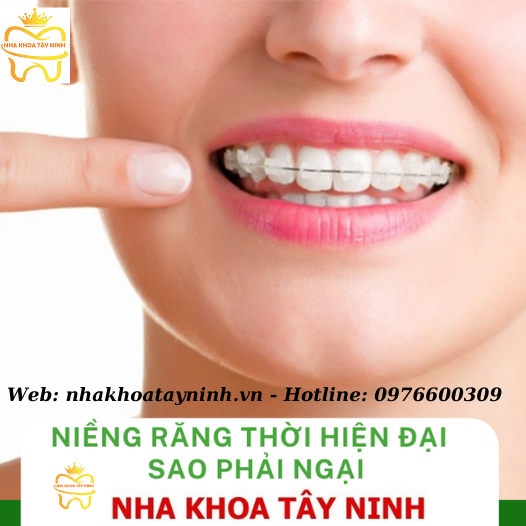 Niềng răng thẩm mỹ uy tín tại Nha Khoa Tây Ninh