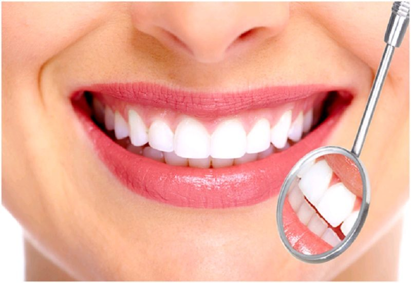 dịch vụ bọc răng sứ tại Tây Ninh