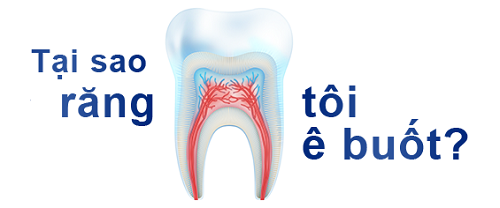 điều trị ê buốt chân răng