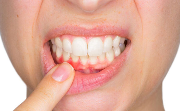 Điều trị bệnh viêm nứu tại Tây Ninh